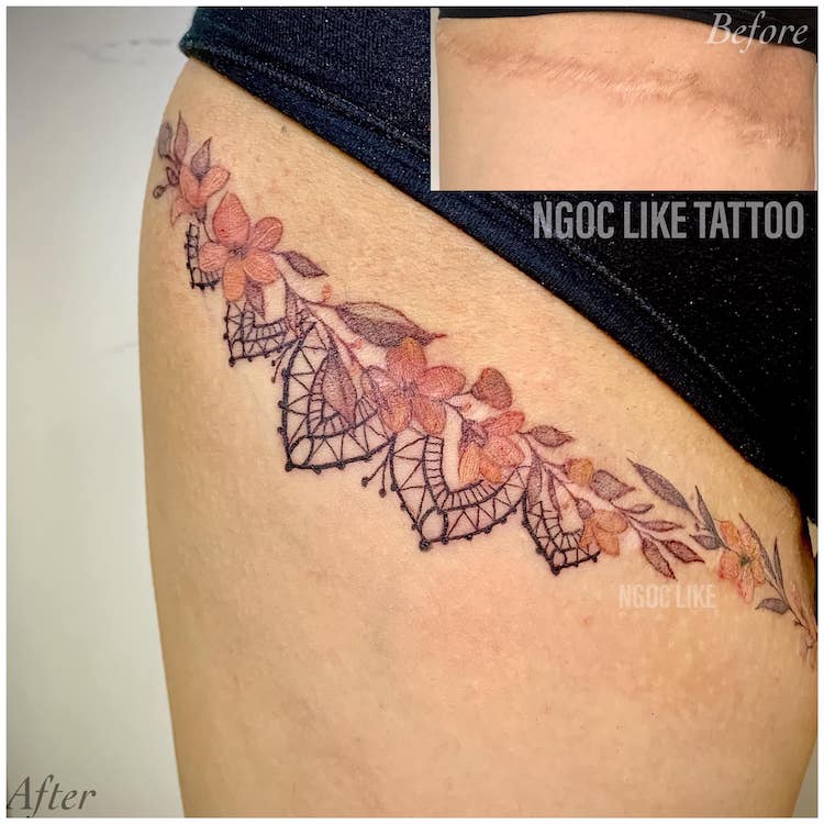 Scar Cover Up Tattoos by Ngoc Like Tattoo