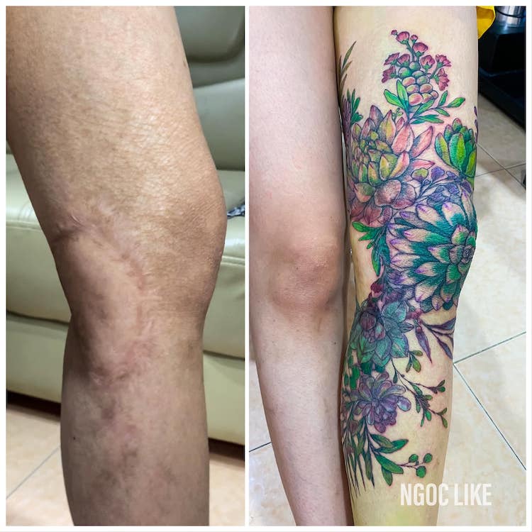 Scar Cover Up Tattoos by Ngoc Like Tattoo