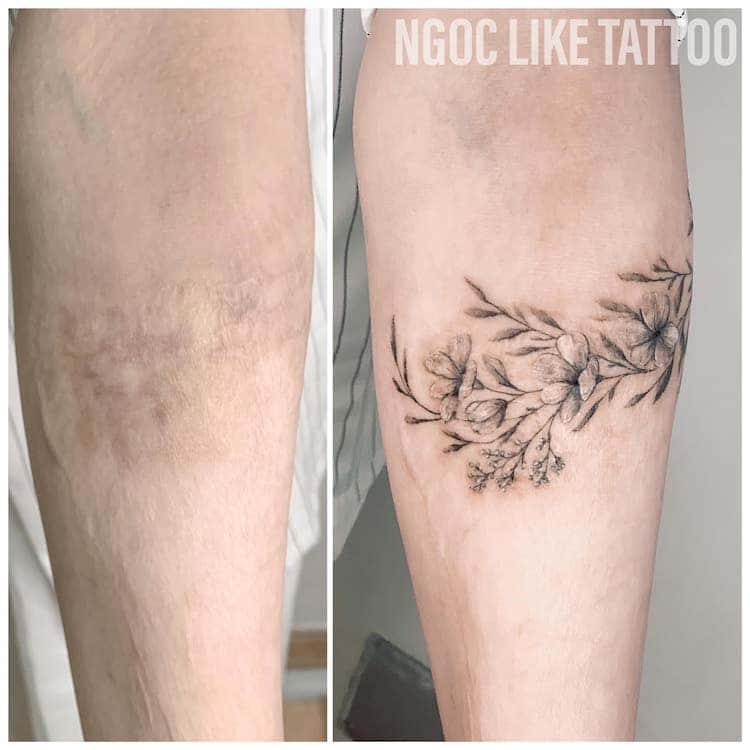 Scar Cover Up Tattoos by Ngoc Like Tattoo