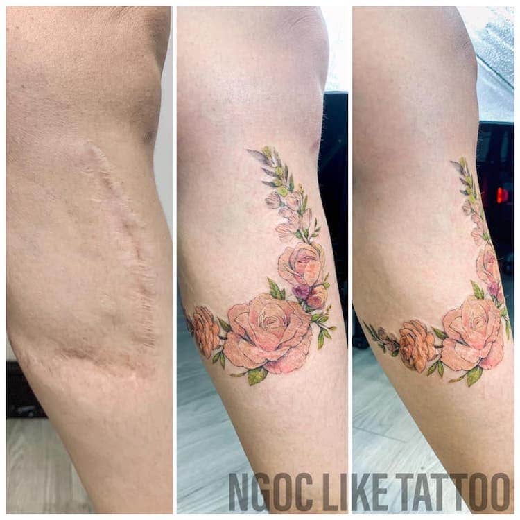 Scar Cover Up Tattoos by Ngoc Like Tattoo