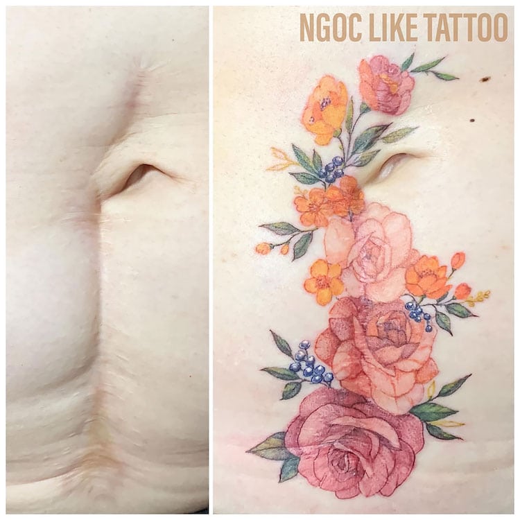 Scar Cover Up Tattoos by Ngoc Like Tattoo